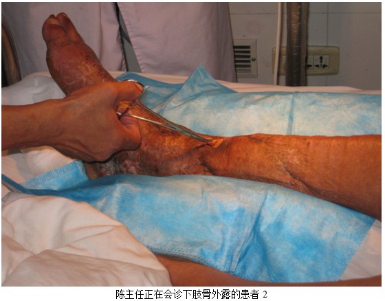 9170金沙集团_皮肤原位再生医疗手艺走进河南省新乡医学院第三隶属医院